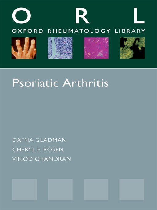 Title details for Psoriatic Arthritis by Dafna Gladman - Available